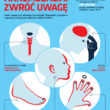 AKROMEGALIA – ZWRÓĆ UWAGĘ!